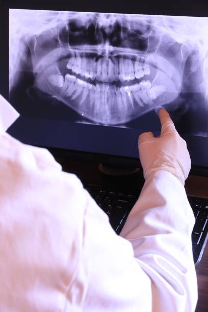 Best Emergency Dental Extractions in Smithfield, NC