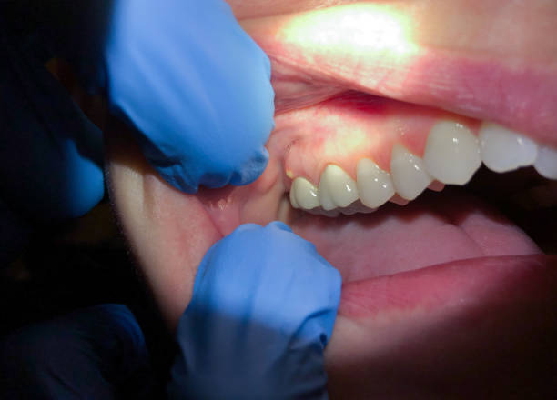 Best Emergency Dental Services for Seniors in Smithfield, NC